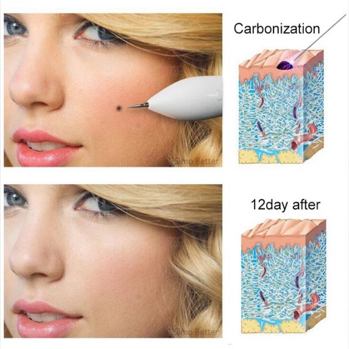 Huislcd Schoonheid van de het Plasmapen van het Scherm de Kosmetische Apparaten voor Tatoegeringsverwijdering
